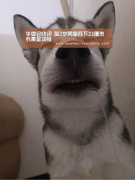 华体会快讯_英2岁男童吞下23厘米长黄金项链(图2) 华体会快讯