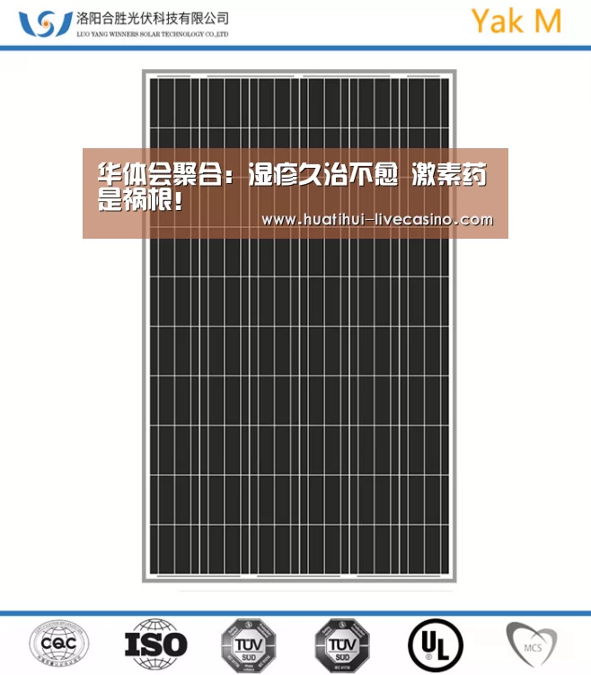 华体会聚合:湿疹久治不愈 激素药是祸根!(图1) 华体会聚合